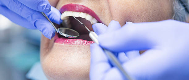 Best Emergency Treatment for Dental Infections or Abscesses in Newark, DE